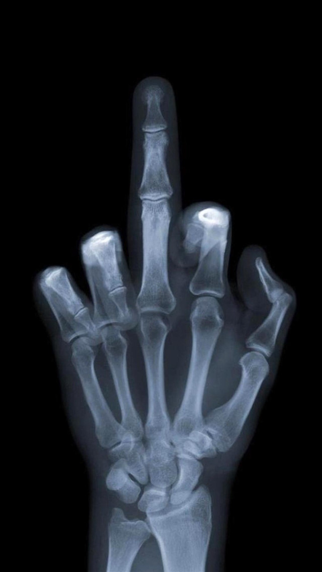 Hand xray thumb area details free wallpaper - medium preview image