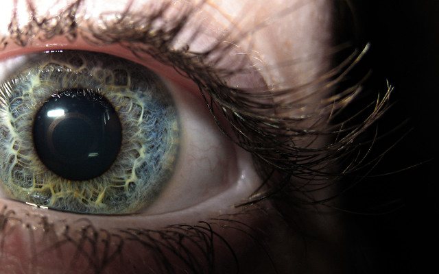 Eye blue iris yellow streaks free wallpaper - medium preview image