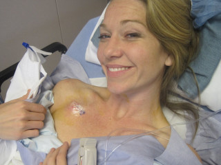 Woman hospital bed bruised arm - upper body free wallpaper