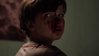 Young boy bloody face serious - a young boy free wallpaper
