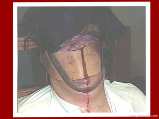 Bandaged man hat blood stained - his mouth free wallpaper