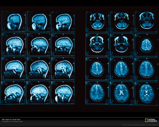 Mri images blue light black - blue light free wallpaper