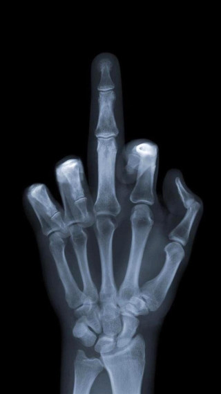 Hand xray thumb area details - ai weiwei free wallpaper