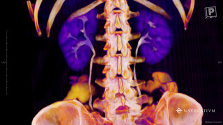 Skeleton purple yellow orange black - a white line free wallpaper